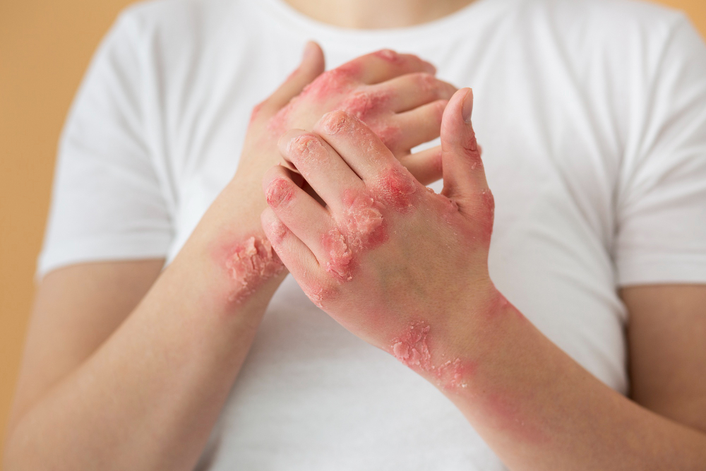 Ayurvedic treatment in Sharjah